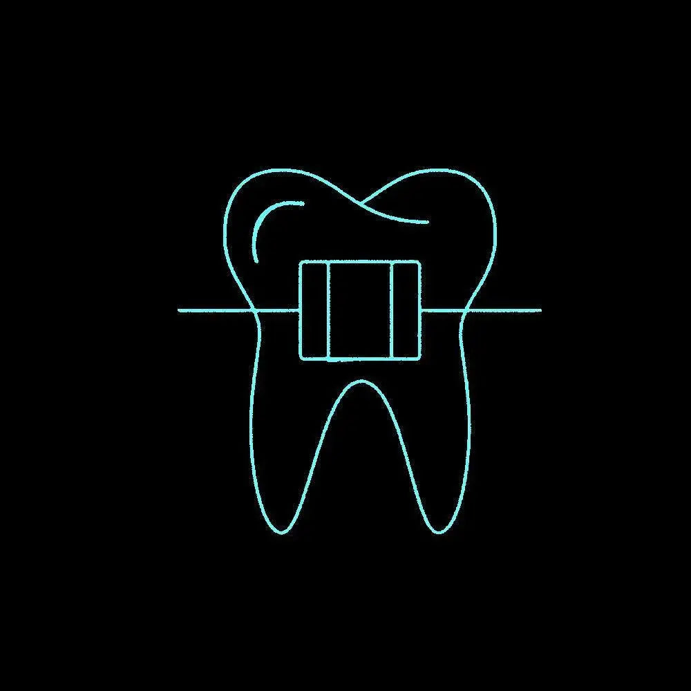 Neon Sign Dental Braces Icon In Line Style Orthodontics Equipment Teeth Alignment Symbol Custom Handmade Real Glass Tube14"X14" FYLZGO Signs